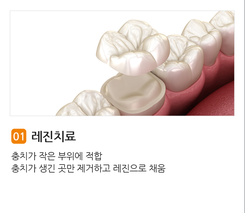 레진치료